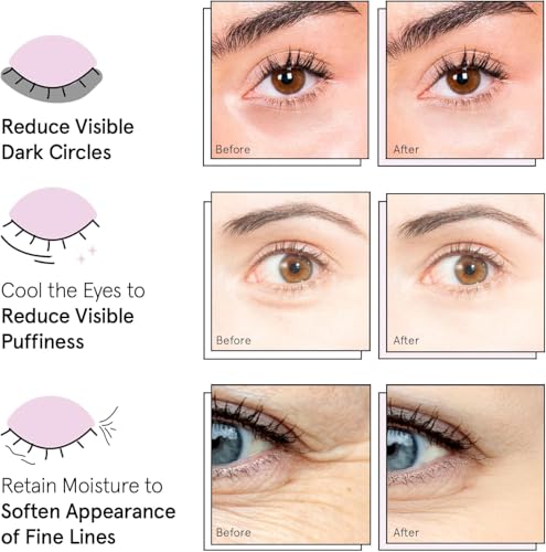 grace & stella Under Eye Mask - Gifts for Women - Travel Essentials - Reduce Dark Circles, Puffy Eyes, Undereye Bags, Wrinkles - Gel Under Eye Patches for Bridesmaid - Vegan Self Care (24 Pairs, Gold) - Image 2